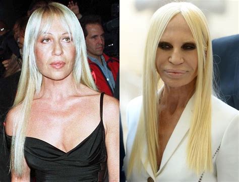 donatella versace contact|donatella versace before and after.